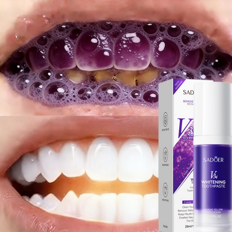 2026 Bestselling Whitening Too - огляд і ціна Teeth Whitening Effective