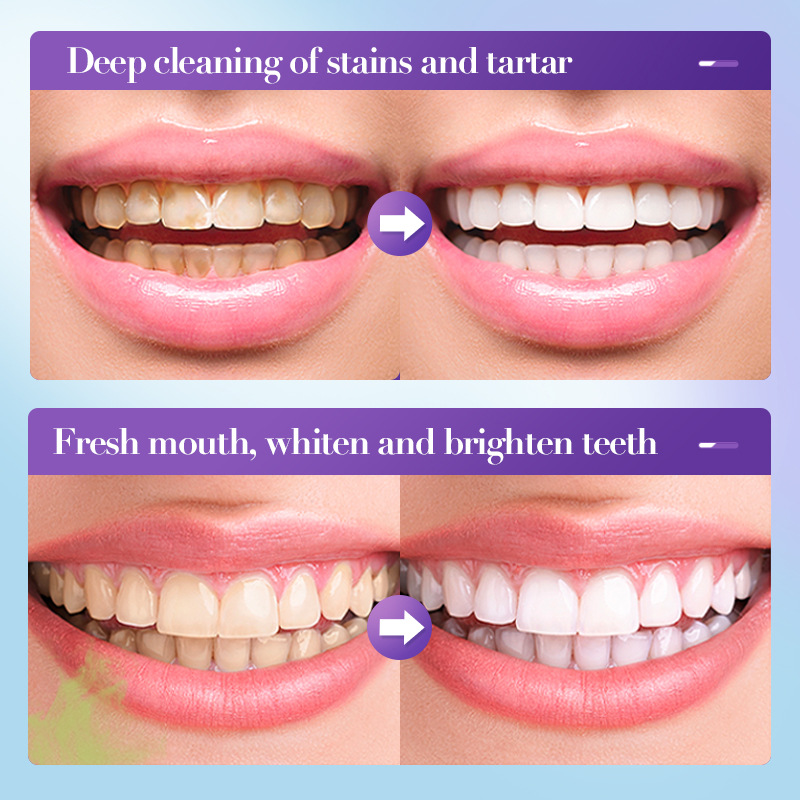 2026 Bestselling Whitening Too - огляд і ціна Teeth Whitening Effective