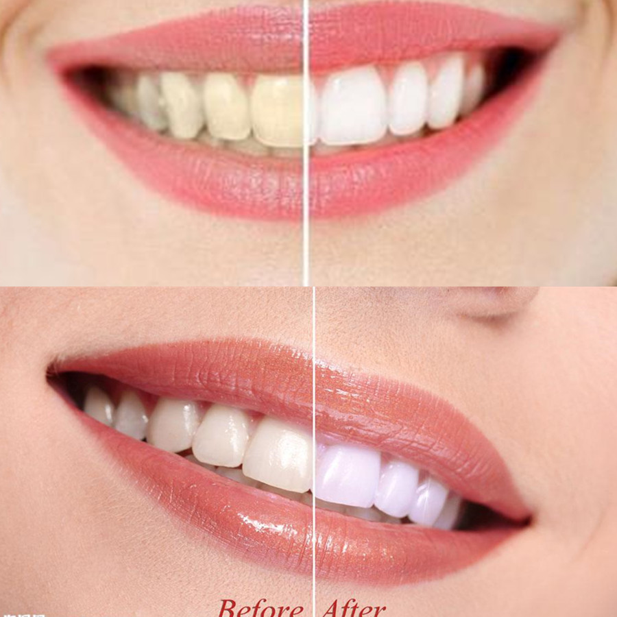 Bamboo Charcoal Teeth Tooth De - огляд і ціна Teeth Whitening Ingredients
