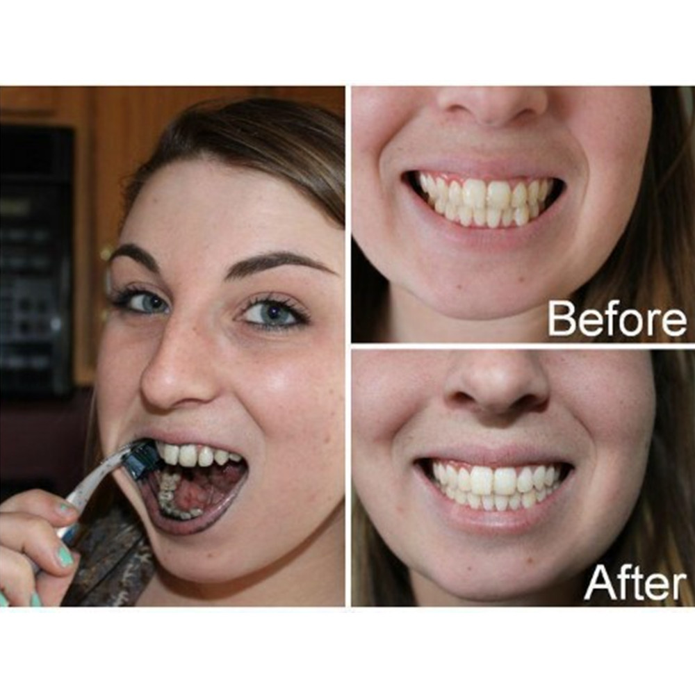 Bamboo Charcoal Teeth Tooth De - огляд і ціна Teeth Whitening Ingredients