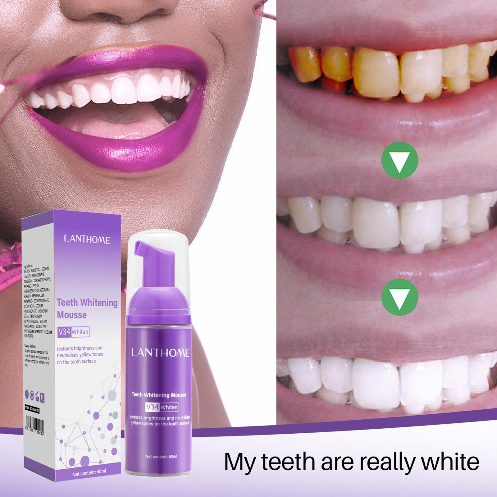 V34 Mousse Teeth Cleaning Toot - огляд і ціна Teeth Whitening Effective