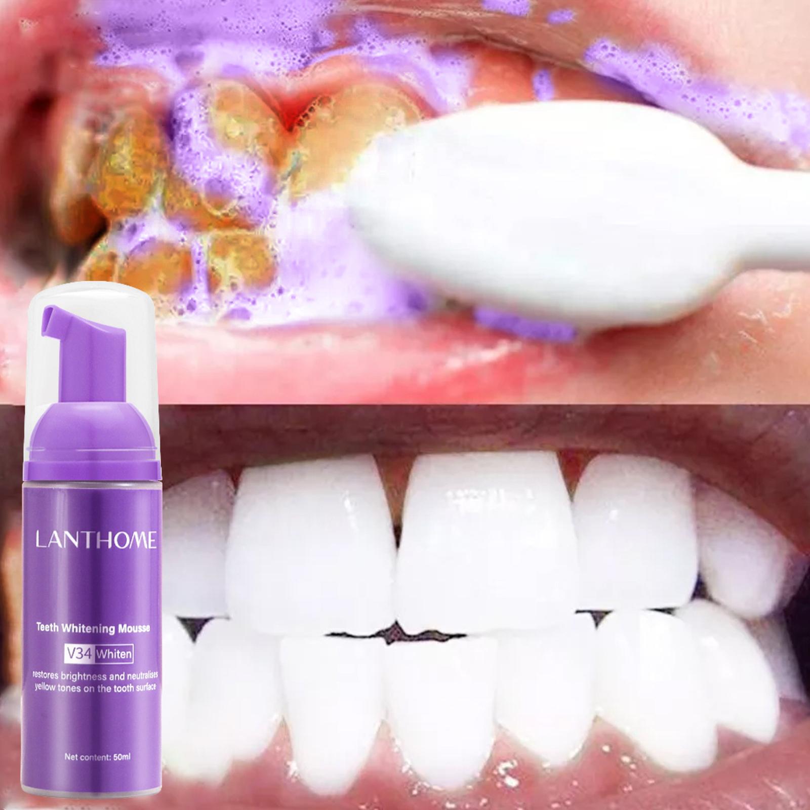 V34 Mousse Teeth Cleaning Toot - огляд і ціна Teeth Whitening Effective