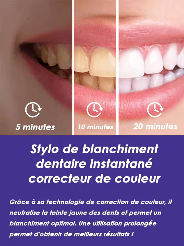 8ml*2 Teeth Whitening Pen Set  - огляд і ціна Teeth Whitening Effective