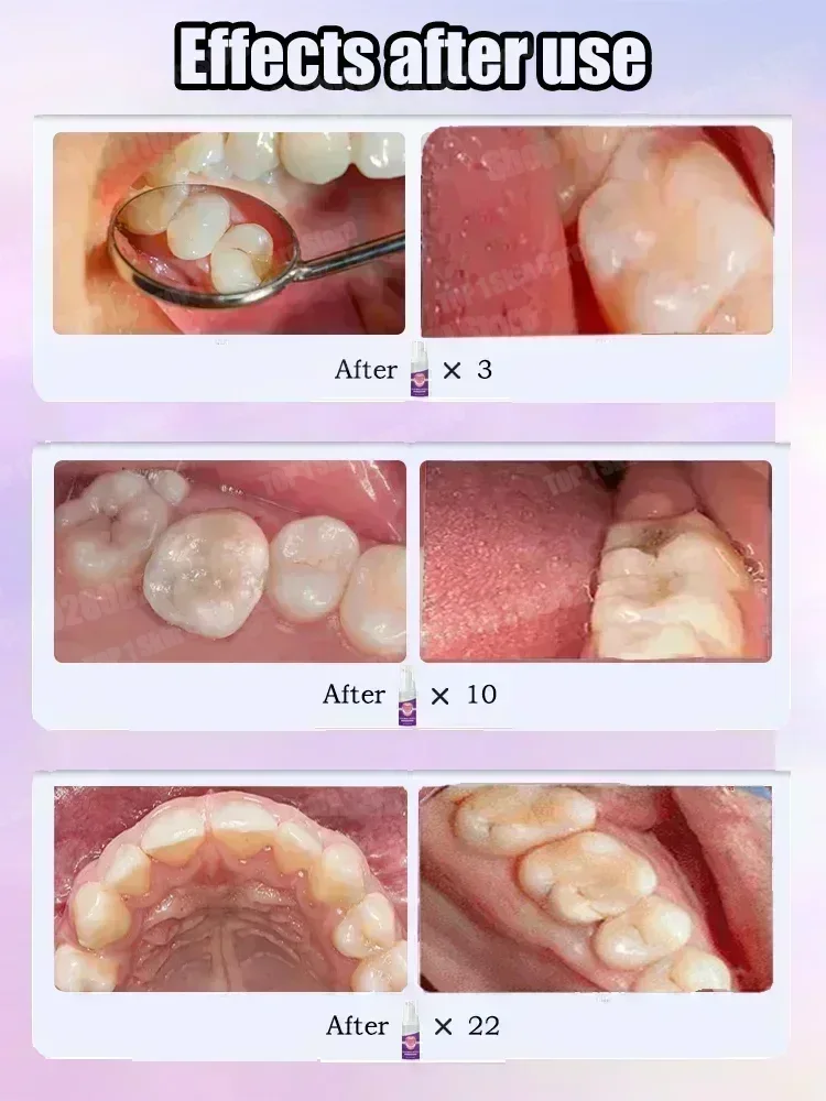 Hot sales Best-selling, Scient - огляд і ціна Teeth Whitening Uv