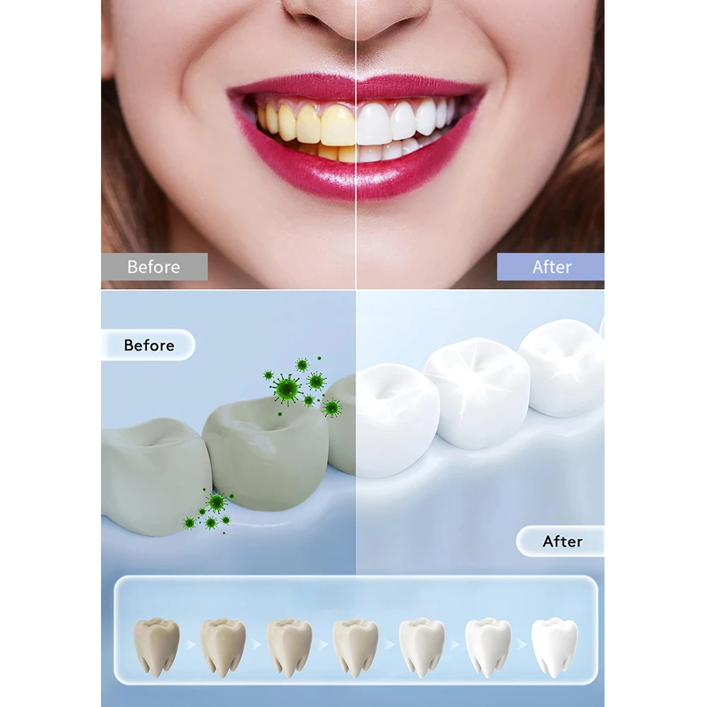 1PC Household Smart LED Teeth  - огляд і ціна Teeth Whitening Uv