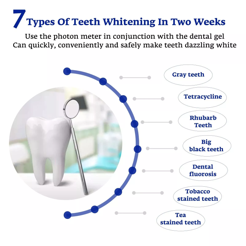 Teeth Whitening Accelerator Sm - огляд і ціна Teeth Whitening Uv