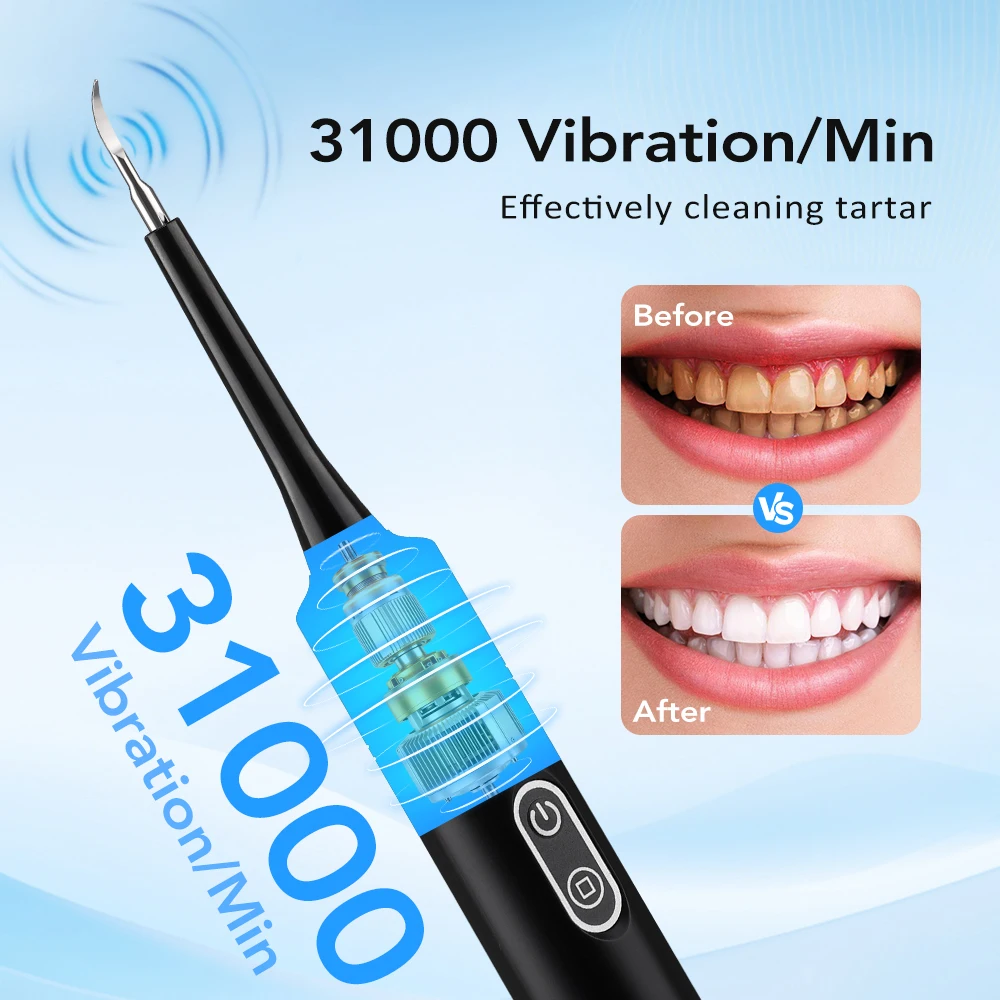 Electric Sonic Vibration Denta - огляд і ціна Teeth Whitening Home